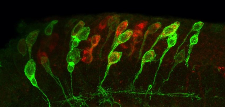 small dormant and enlarged reactivated neural stem cells in fruit fly