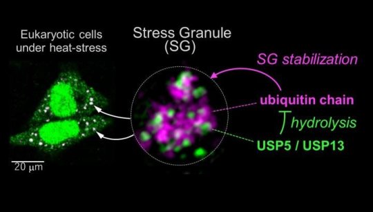 Addio 'granuli dello stress': studio amplia le possibilità di trattare le malattie neurologiche