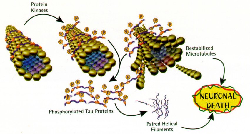 tau phosphorylation leading to neuronal death