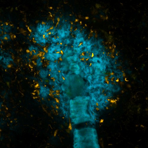 Progettate molecole-camaleonte che distinguono l'amiloide dalla tau