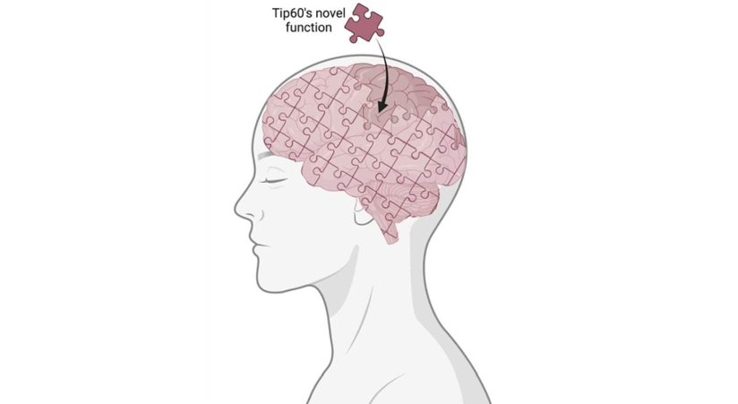 tip60 brain puzzle