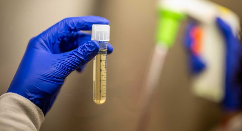vial with fluid from UCSF