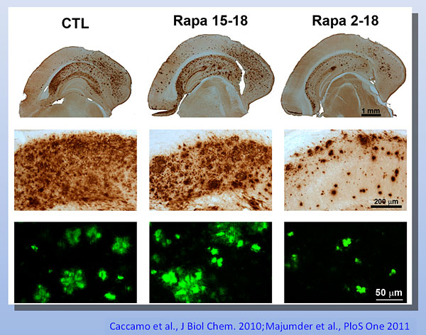 In un modello di topo di Alzheimer, c'è un significativo accumulo di placche amiloidi-β nel cervello (CTL). La rapamicina inibisce l'accumulo di placche quando somministrata come profilassi ai topi dal secondo mese di vita (Rapa 2-18), ma non quando é somministrata a da 3 a 15 mesi di età degli animali, perché la malattia è già progredita troppo (Rapa 15 - 18). Le macchie marroni nelle prime due serie di immagini e quelle verdi nella serie in basso rappresentano placche amiloidi. (Immagine: Salvatore Oddo) Clicca per ingrandire